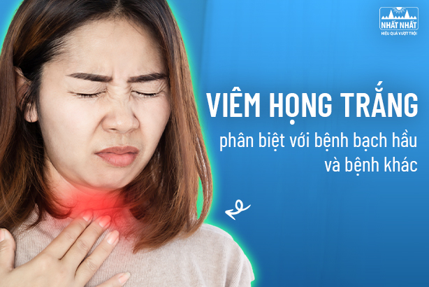 Viêm họng trắng – phân biệt với bệnh bạch hầu và bệnh khác