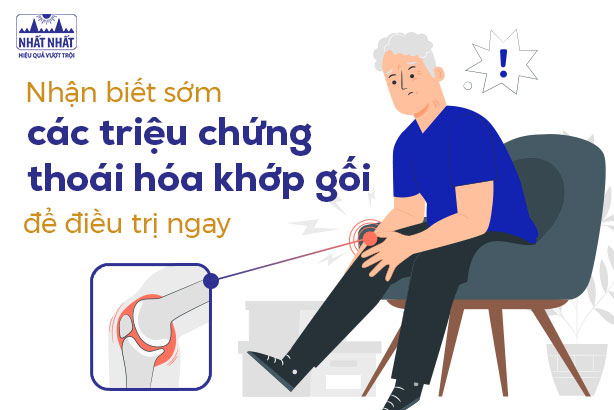 Nhận biết sớm các triệu chứng thoái hóa khớp gối để điều trị ngay