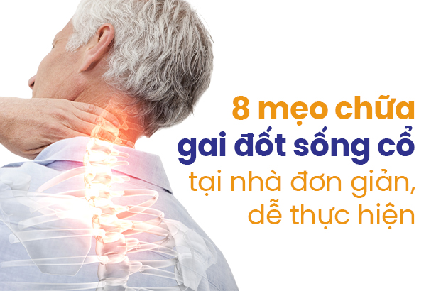 8 mẹo chữa gai đốt sống cổ tại nhà đơn giản, dễ thực hiện