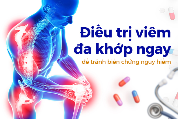 Điều trị viêm đa khớp ngay để tránh biến chứng nguy hiểm