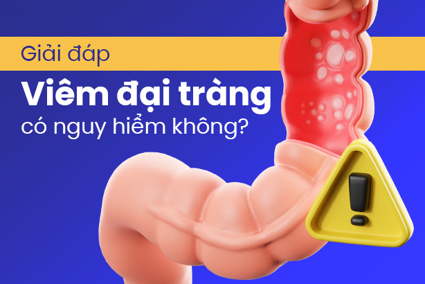 Giải đáp: Viêm đại tràng có nguy hiểm không?