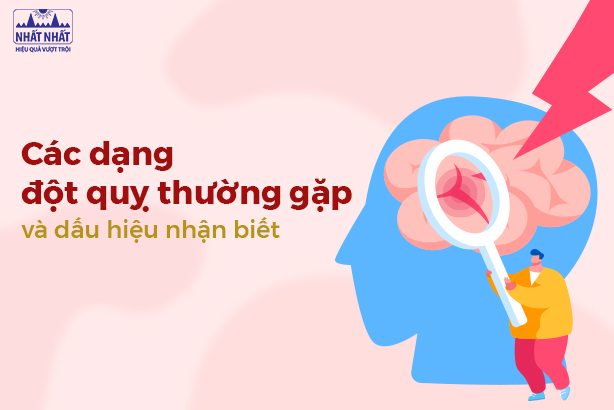 Các dạng đột quỵ thường gặp và dấu hiệu nhận biết đột quỵ