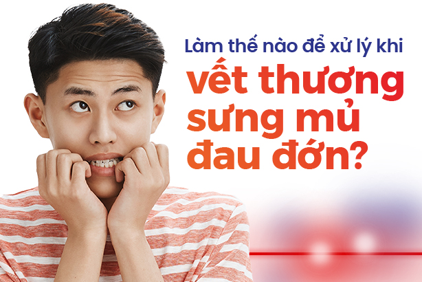 Làm thế nào để xử lý khi vết thương sưng mủ đau đớn?