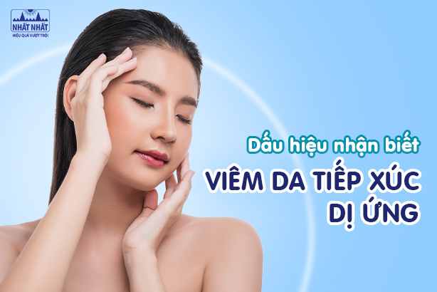 Dấu hiệu nhận biết viêm da tiếp xúc dị ứng phổ biến nhất 