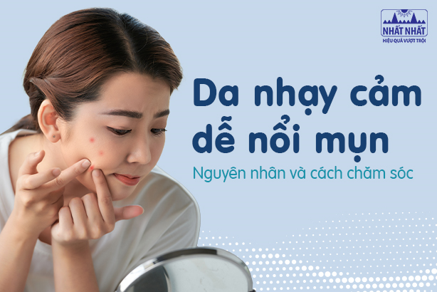 Da nhạy cảm dễ nổi mụn: Nguyên nhân và cách chăm sóc