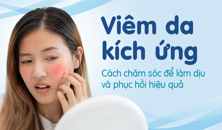 Viêm da kích ứng: Cách chăm sóc để làm dịu và phục hồi hiệu quả