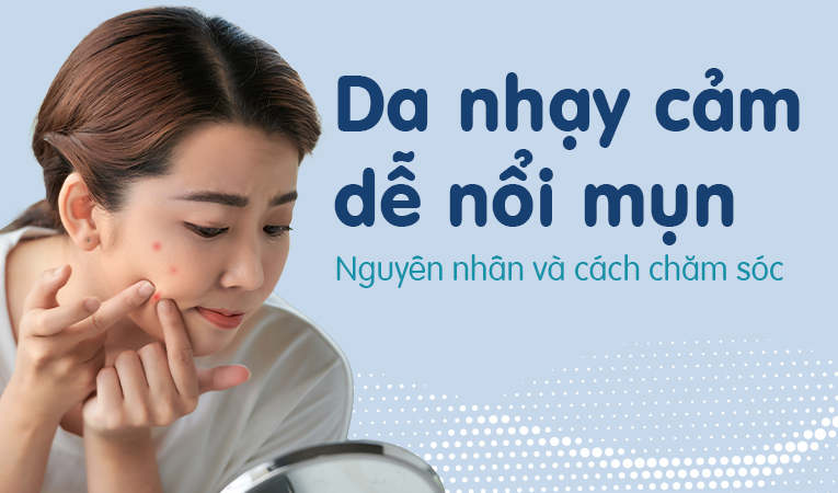 Da nhạy cảm dễ nổi mụn: Nguyên nhân và cách chăm sóc