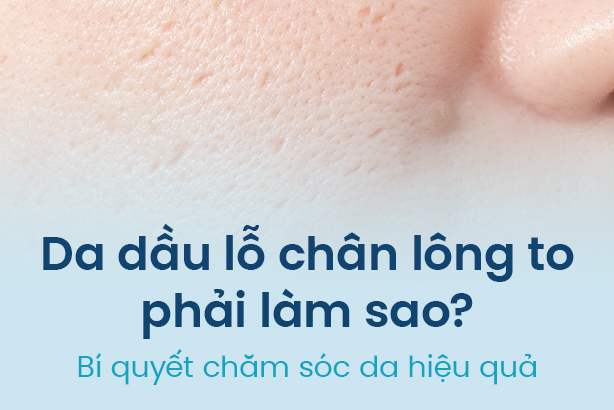 Da dầu lỗ chân lông to phải làm sao? Bí quyết chăm sóc da hiệu quả