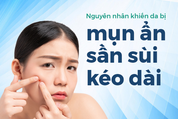 Nguyên nhân khiến da bị mụn ẩn sần sùi kéo dài