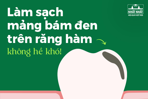 Làm sạch mảng bám đen trên răng hàm không hề khó!