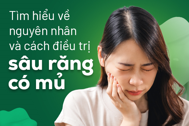 Tìm hiểu về nguyên nhân và cách điều trị sâu răng có mủ