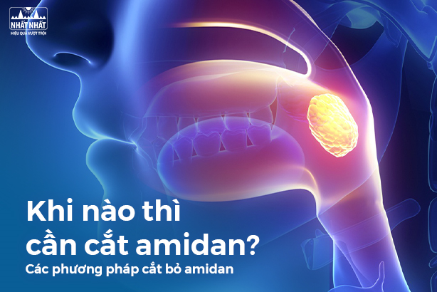 Khi nào thì cần cắt amidan? Cách phương pháp cắt bỏ amidan hiện nay