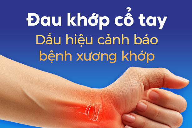 Đau khớp cổ tay: Dấu hiệu cảnh báo bệnh xương khớp
