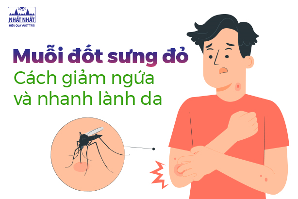 Muỗi đốt sưng đỏ: Cách giảm ngứa và nhanh lành da