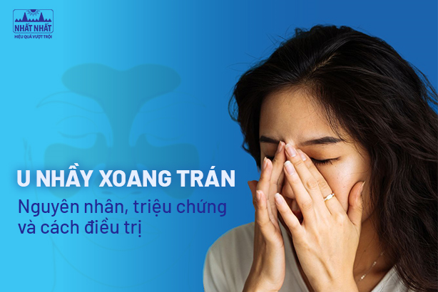 U nhầy xoang trán: Nguyên nhân, triệu chứng và cách điều trị
