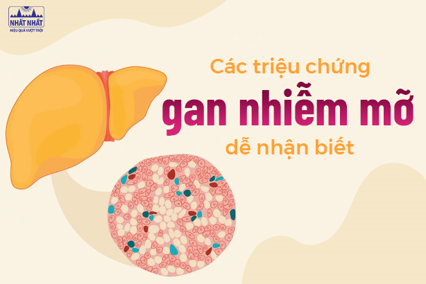 Các triệu chứng gan nhiễm mỡ dễ nhận biết 