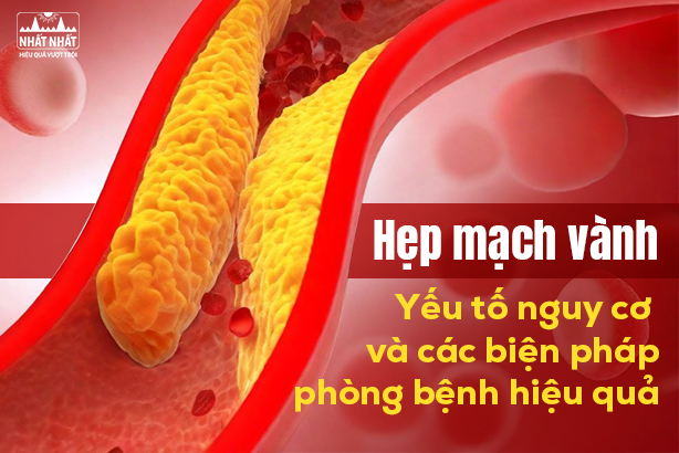 Hẹp mạch vành: Yếu tố nguy cơ và các biện pháp phòng bệnh hiệu quả