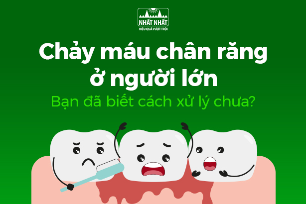 Chảy máu chân răng ở người lớn: Bạn đã biết cách xử lý chưa?