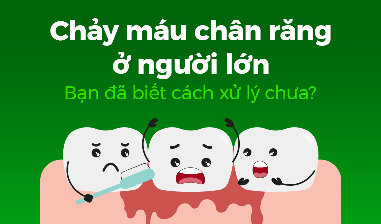 Chảy máu chân răng ở người lớn: Bạn đã biết cách xử lý chưa?