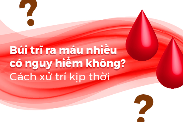 Búi trĩ ra máu nhiều có nguy hiểm không? Cách xử trí kịp thời