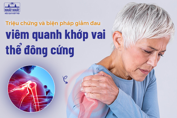 Các triệu chứng và biện pháp giảm đau viêm quanh khớp vai thể đông cứng