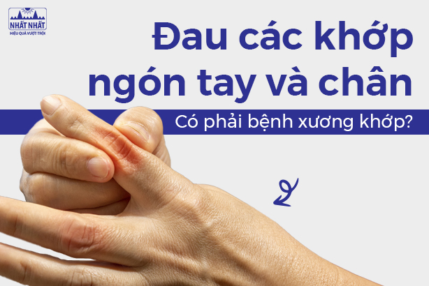 Đau các khớp ngón tay và chân: Có phải bệnh xương khớp?