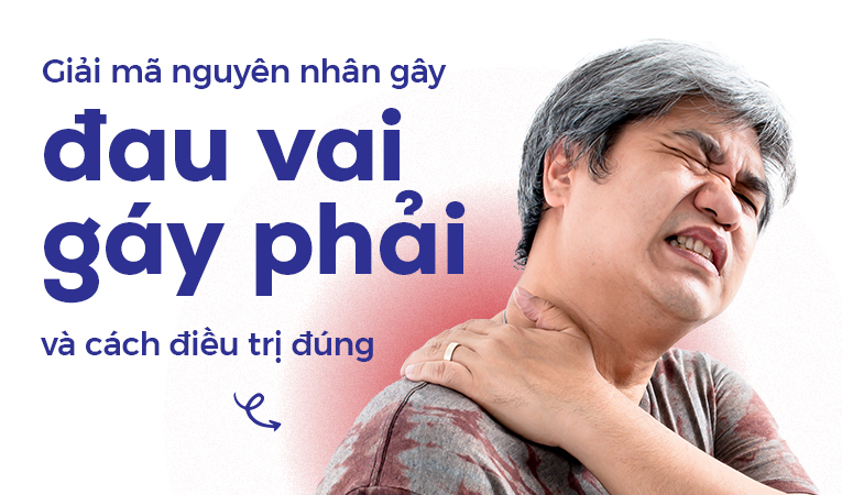 Giải mã nguyên nhân gây đau vai gáy phải và cách điều trị đúng 