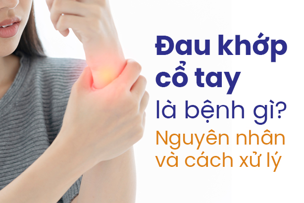 Đau khớp cổ tay là bệnh gì? Nguyên nhân và cách xử lý