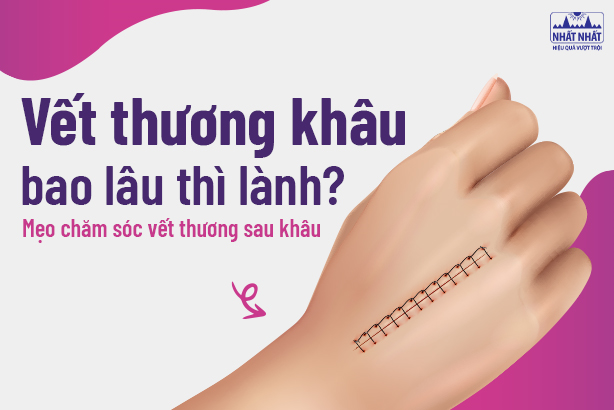 Vết thương khâu bao lâu thì lành? Mẹo chăm sóc vết thương sau khâu