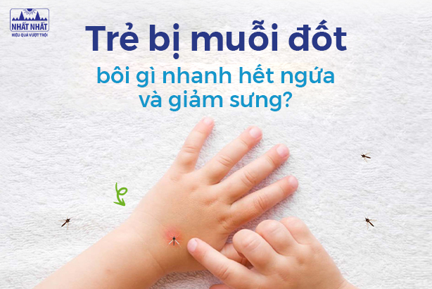 Trẻ bị muỗi đốt bôi gì nhanh hết ngứa và giảm sưng?