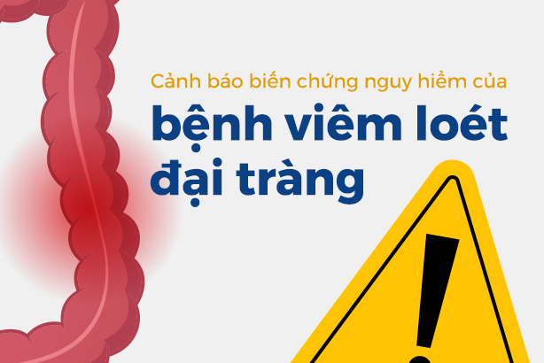 Cảnh báo biến chứng nguy hiểm của bệnh viêm loét đại tràng