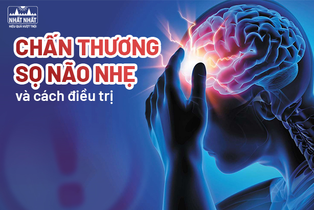 Nhận biết triệu chứng chấn thương sọ não nhẹ và cách điều trị