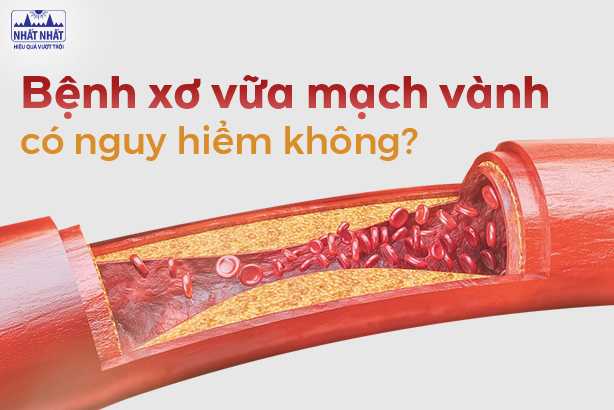 Tư vấn: Bệnh xơ vữa mạch vành có nguy hiểm không?