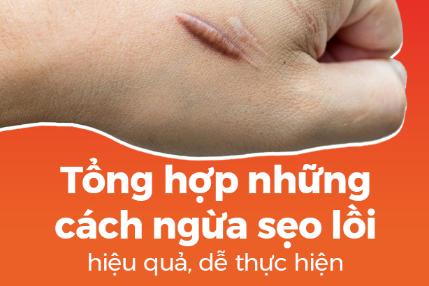 Tổng hợp những cách ngừa sẹo lồi hiệu quả, dễ thực hiện