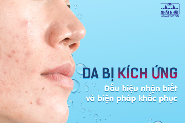 Da bị kích ứng: Dấu hiệu nhận biết và biện pháp khắc phục