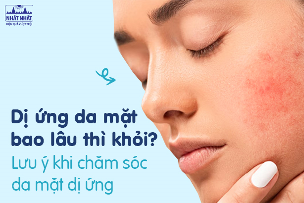 Dị ứng da mặt bao lâu thì khỏi? Những lưu ý khi chăm sóc da mặt dị ứng