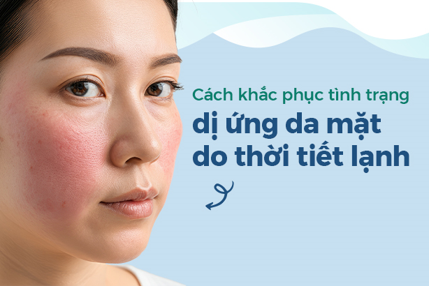 Cách khắc phục tình trạng dị ứng da mặt do thời tiết lạnh