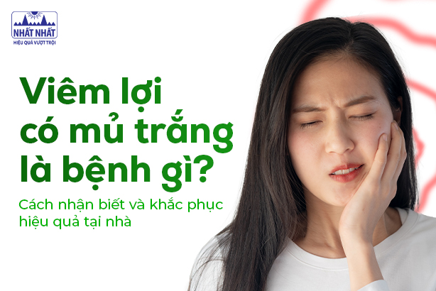 Viêm lợi có mủ trắng là bệnh gì? Cách nhận biết và khắc phục hiệu quả tại nhà