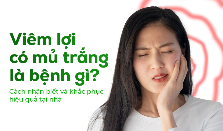 Viêm lợi có mủ trắng là bệnh gì? Cách nhận biết và khắc phục hiệu quả tại nhà