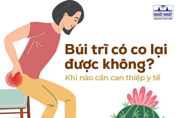 Búi trĩ có co lại được không? Khi nào cần can thiệp y tế