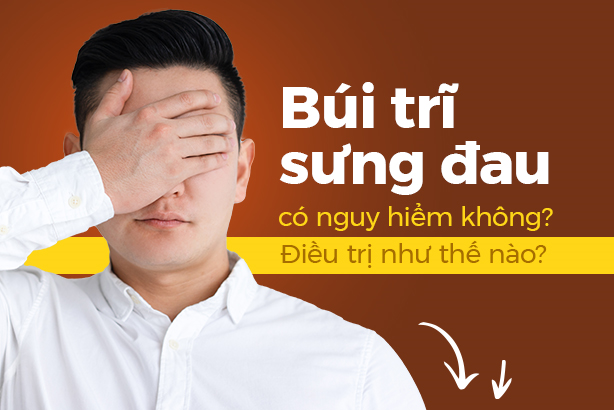 Búi trĩ sưng đau có nguy hiểm không? Điều trị như thế nào?
