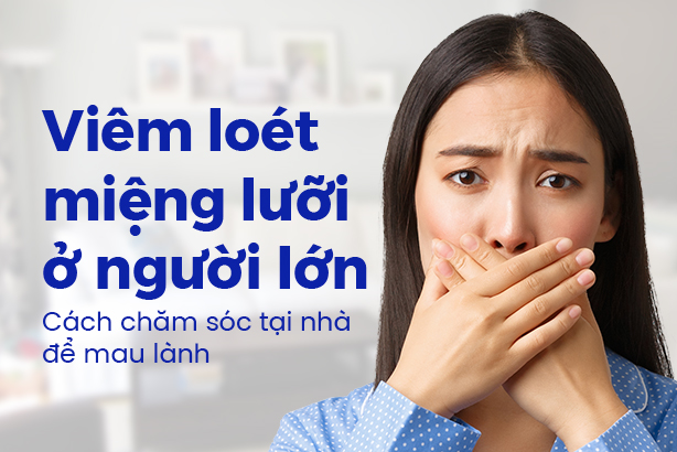 Viêm loét miệng lưỡi ở người lớn: Cách chăm sóc tại nhà để mau lành