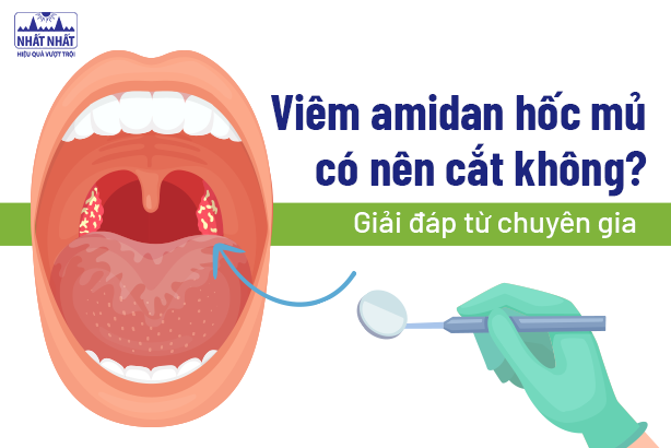 Viêm amidan hốc mủ có nên cắt không: Giải đáp từ chuyên gia