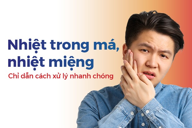 Nhiệt trong má, nhiệt miệng: Chỉ dẫn cách xử lý nhanh chóng