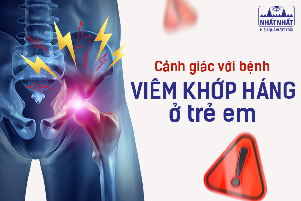 Cảnh giác với bệnh viêm khớp háng ở trẻ em