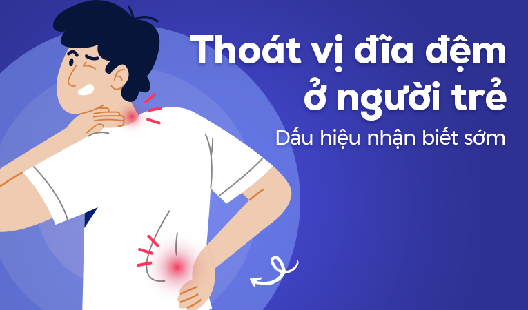 Thoát vị đĩa đệm ở người trẻ: Dấu hiệu nhận biết sớm