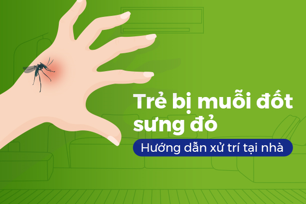 Trẻ bị muỗi đốt sưng đỏ: Hướng dẫn xử trí tại nhà