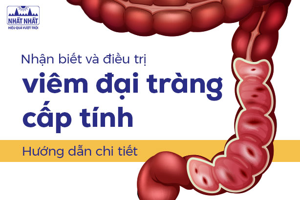 Nhận biết và điều trị viêm đại tràng cấp tính: Hướng dẫn chi tiết