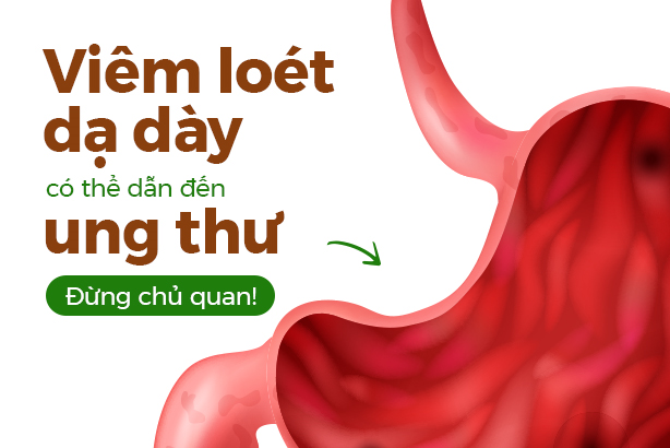 Viêm loét dạ dày có thể dẫn đến ung thư – Đừng chủ quan!
