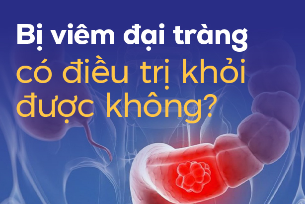 Bị viêm đại tràng có điều trị khỏi được không?